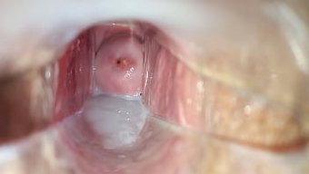 用这个特写窥视器视频...