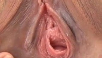 女性阴道拉伸 - 欧洲视角
