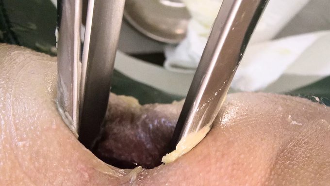 医生和护士使用巨大的窥阴器进行激烈的拳交会话